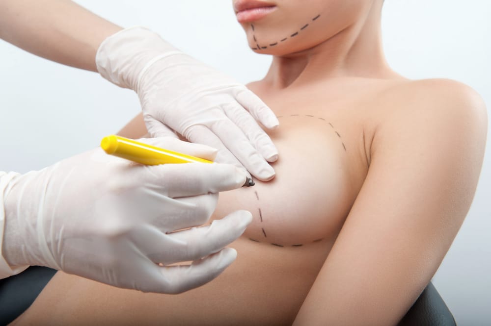 Breast Augmentation (Enlargement)